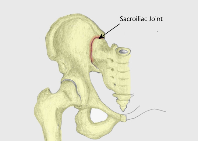 sacroiliac_joint1.