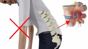 6 Simple Lifestyle changes to prevent Lower Back Pain