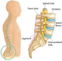 severe spinal pain