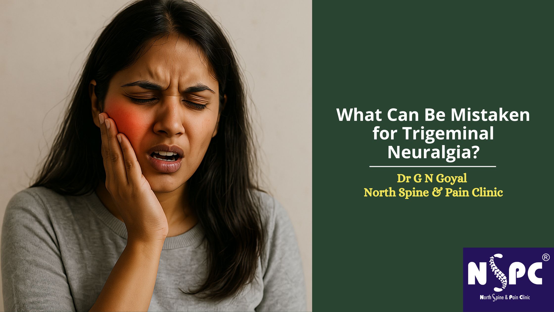 What can be mistaken for trigeminal neuralgia
